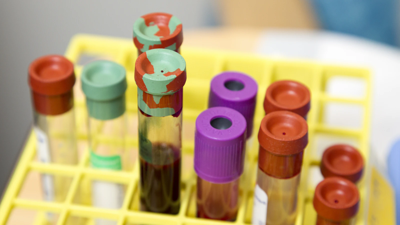 Lege glazen buisjes klaar voor bloedonderzoek in het lab.
